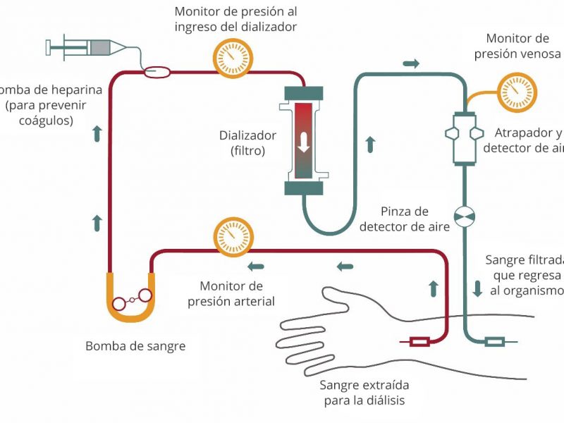 hemodialysis-blood-flow_V2